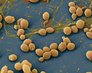 Грибы рода Candida под микроскопом