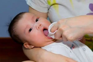 Налет от молочницы во рту у ребенка