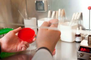 Сдайте анализ на грибок