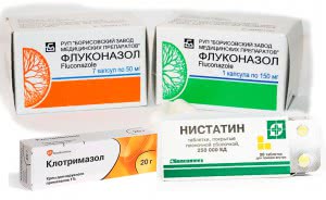 Комплексное лечение молочницы