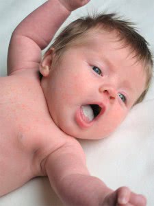 кандидоз слизистой во рту у новорождённого