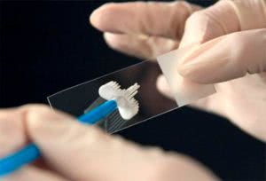 Анализ мазка на молочницу